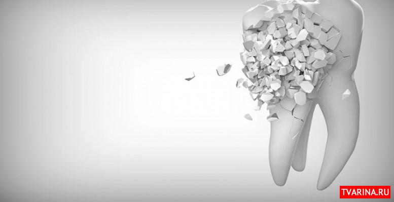 Коронка на зуб: особенности конструкции и ее использование